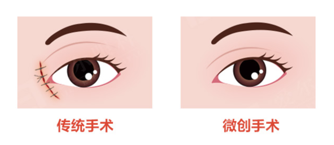 图片.png 图片.png